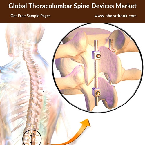 Global Thoracolumbar Spine Devices Market -Bharat Book Bureau